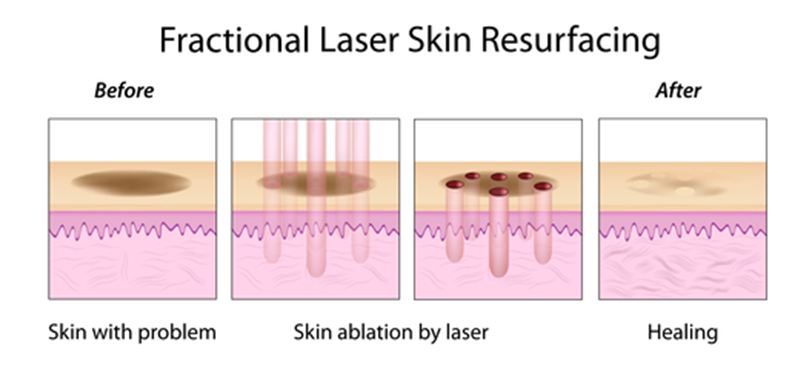 drug-delivery-dermatologia-e-saude-350x300-2