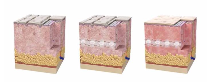 Skinboosters hidratacao-injetavel-na-pele-skinboosters