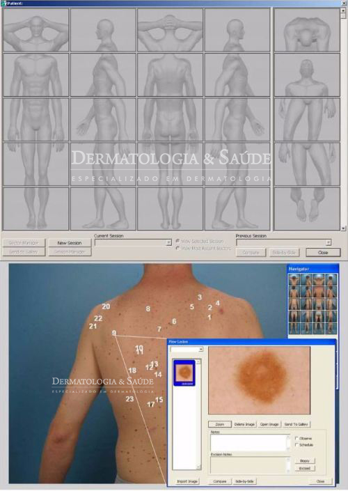 mapeamento-corporal-e-dermatoscopia-digital-dermatologia-e-saude-01