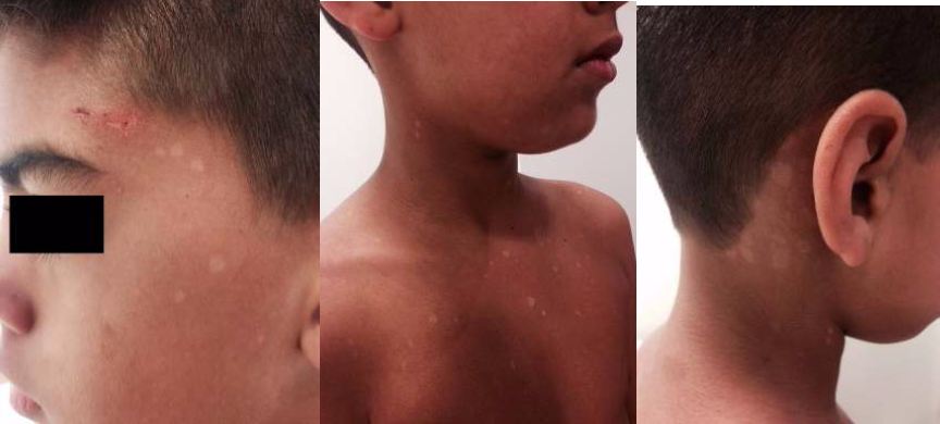 pano-branco-dermatologia-e-saude-02-350x300