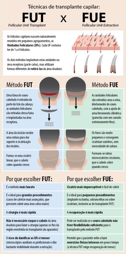 tecnicas-modernas-de-transplante-capilar-dermatologia-e-saude-350-300-1
