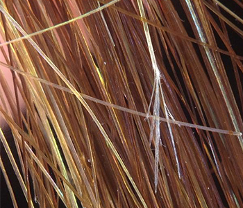 tricologia-dermatologia-e-saude-01-350x300