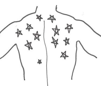 Roberto Klotz dermatologia-e-saude-entrevista-roberto-klotz-dermatologia-e-saude-350x300-1