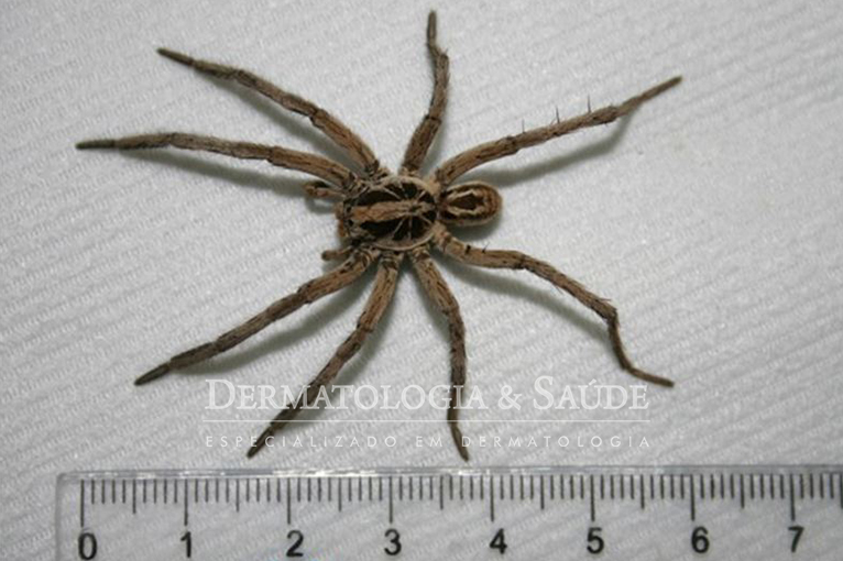 Figura 1- Tamanho médio da Lycosa e detalhe da seta negra em seu abdome