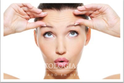 rugas-linhas-de-expressão-toxina-botulinica-Botox