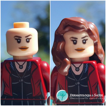 O-que-voce-precisa-saber-sobre-queda-de-cabelos-na-quimioterapia-dermatologia-e-saude-4