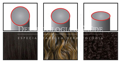 1-asiático 2-caucasiano 3-afrodescendente