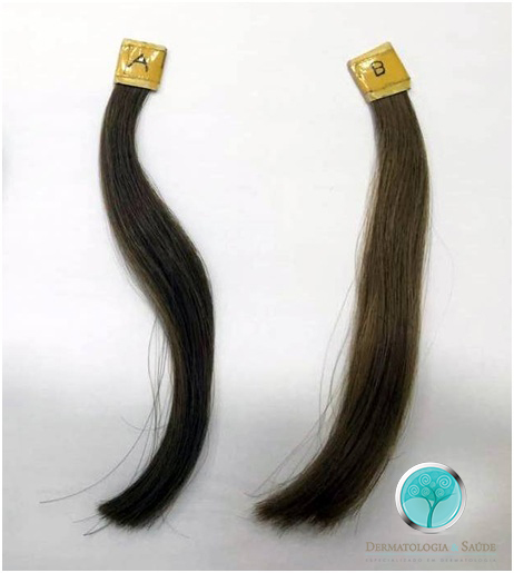 Cabelos tingidos, da mesma pessoa, submetidos ao tratamento com filtros solares e espectofotômetro( aparelho que imita a luz do sol), por 15 dias. A mecha da esquerda, (A), foi tratada com filtros solares. A da esquerda, (B), não. É nítida a diferença entre as duas: A que não foi tratada com filtros solares se tornou mais clara, com menos brilho e mais áspera.