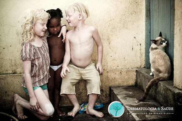 Ensaio fotográfico - "À flor da Pele" - AlexandreSevero