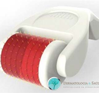 O microagulhamento pode ser feito utilizando-se vários tipos de dispositivos com agulhas que variam de 0,5 a 2,5 mm de comprimento.