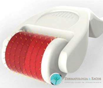 O microagulhamento pode ser feito utilizando-se vários tipos de dispositivos com agulhas que variam de 0,5 a 2,5 mm de comprimento.