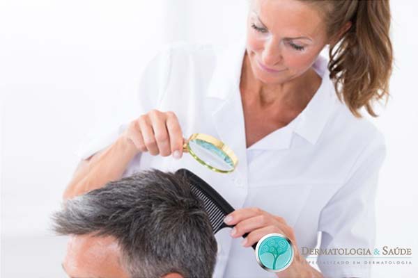 queda-de-cabelo-definitiva-alopecias-cicatriciais-dermatologia-e-saude-3