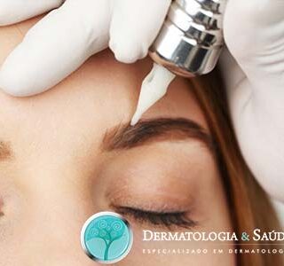 Micropigmentadora usando dermógrafo.