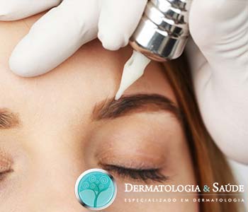 Micropigmentadora usando dermógrafo.