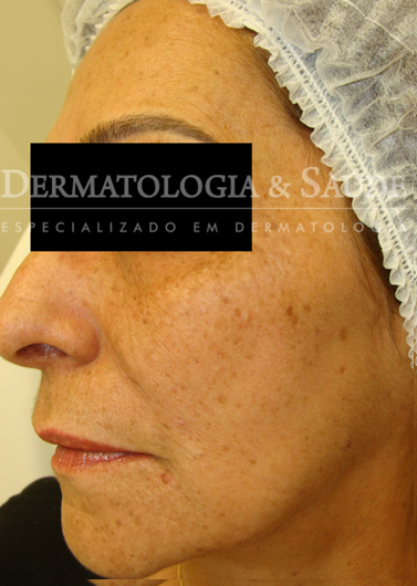 Face feminina envelhecida