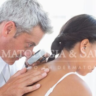 A importância do exame dermatológico na prevenção do câncer de pele