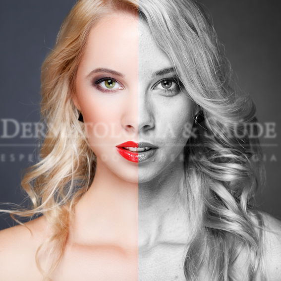 peeling-manchas-rejuvenescimento-acne-estrias-dematologia-e-saude