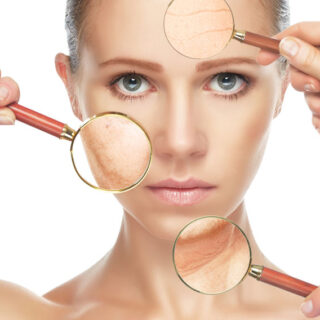 Toxina botulínica ameniza rugas e linhas de expressão